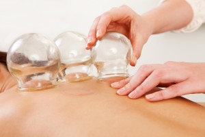 Cupping in Traditional Chinese Medicine